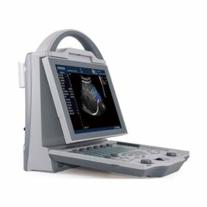 Portable Color Doppler Ultrasound DCU-12