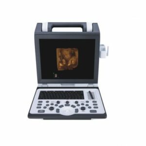 Apogee 2100 Ultrasound Machine