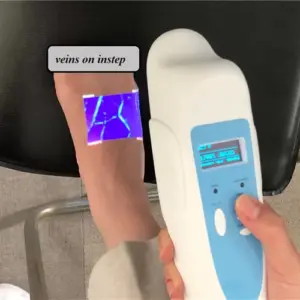 Professional vein finder MAS-S1