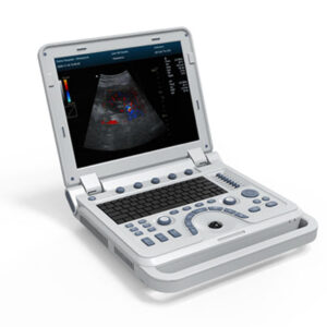 CMS600P2Plus B Ultrasound – Portable with Abdomen Convex Probe
